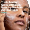 Cetaphil Gentle Clear Acne Foaming Face Wash, 2% Salicylic Acid, 8oz(8 Fl Oz (Pack of 12))