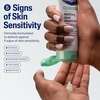 Cetaphil Gentle Clear BPO Acne Face Wash, Soothing, Sensitive Skin, 4.2oz(3 Fl Oz (Pack of 12))